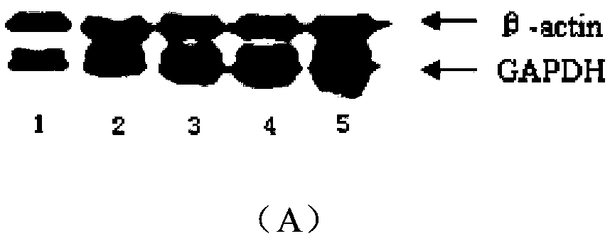 SiRNA (small interfering ribose nucleic acid) for inhibiting homosapiens chromosome2open reading frame 3(C2 or f3) (GCF) gene expression, carrier of SiRNA for inhibiting GCF gene expression and application