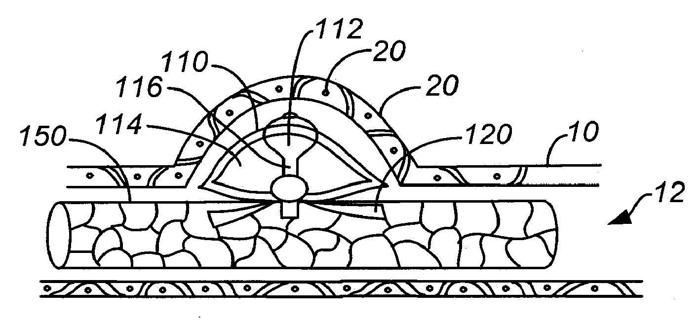 Aneurysm treatment devices