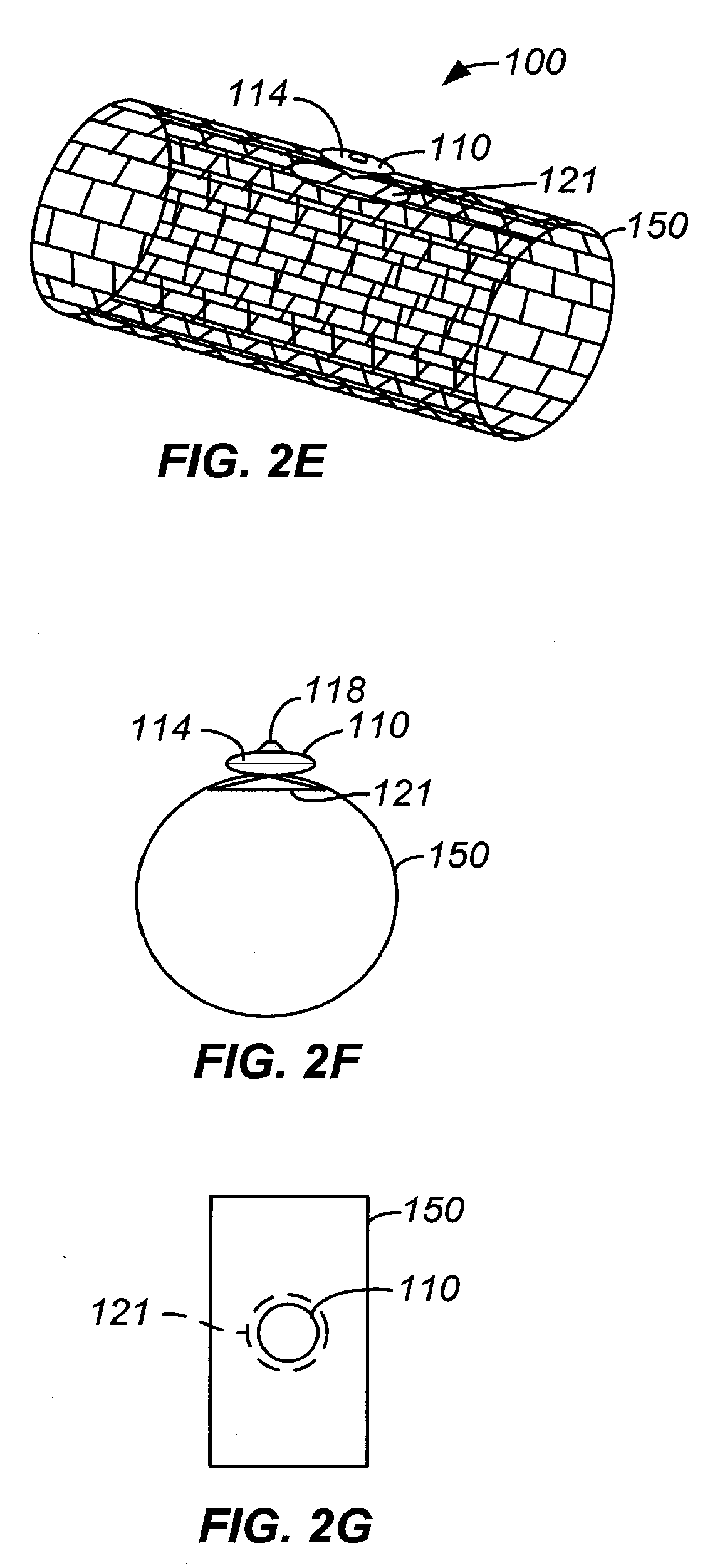 Aneurysm treatment devices