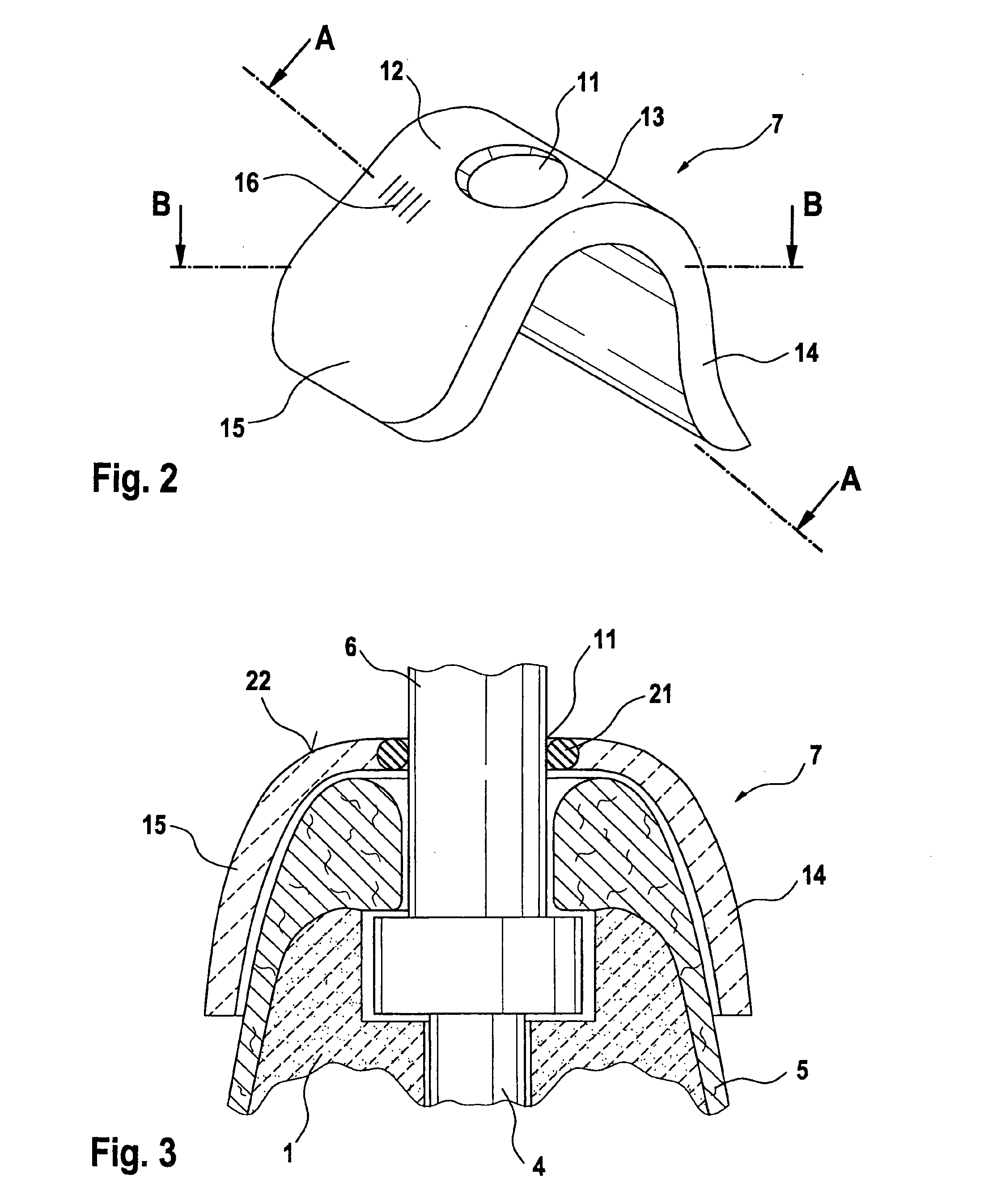 Equalizing device and method of measurement in teeth restorations