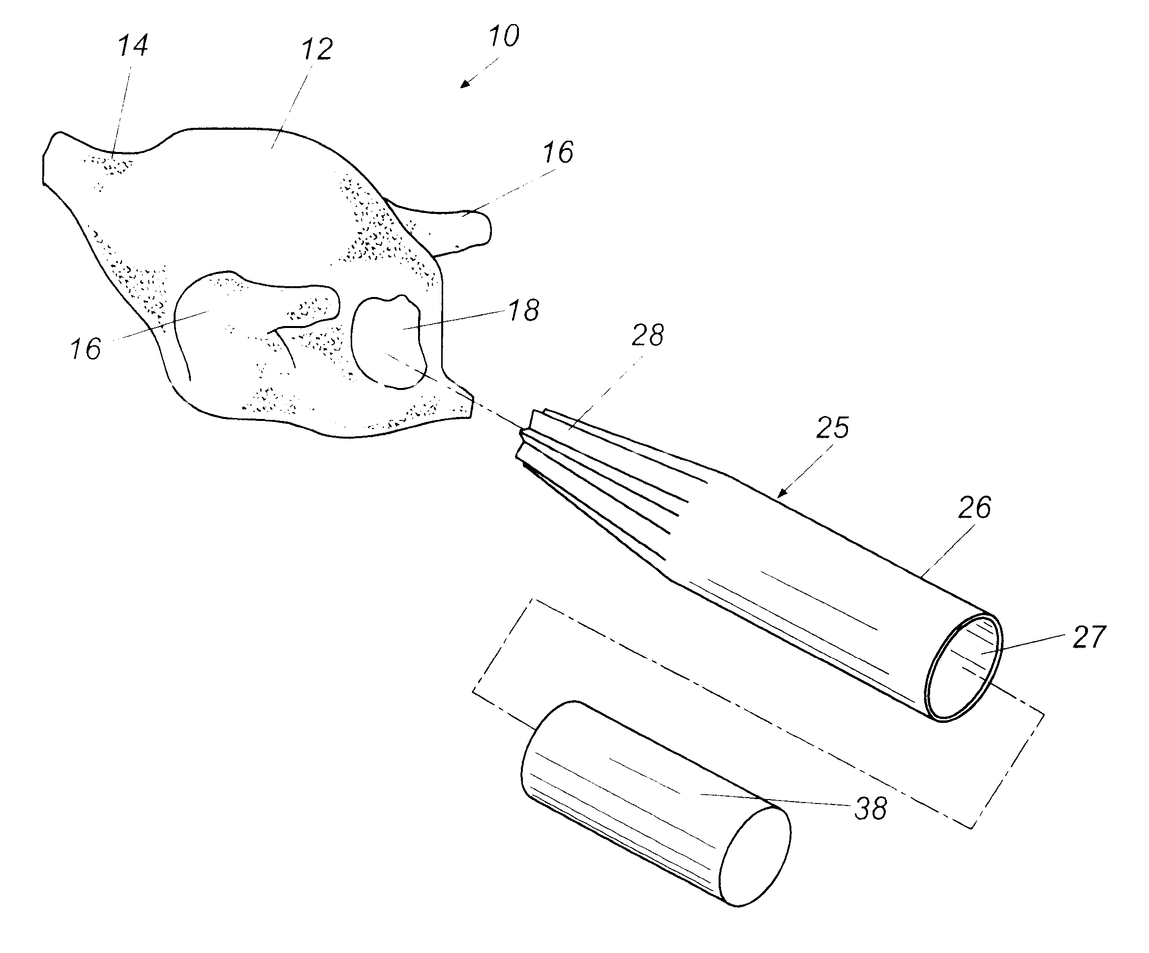 Poultry visceral cavity shaping method and product