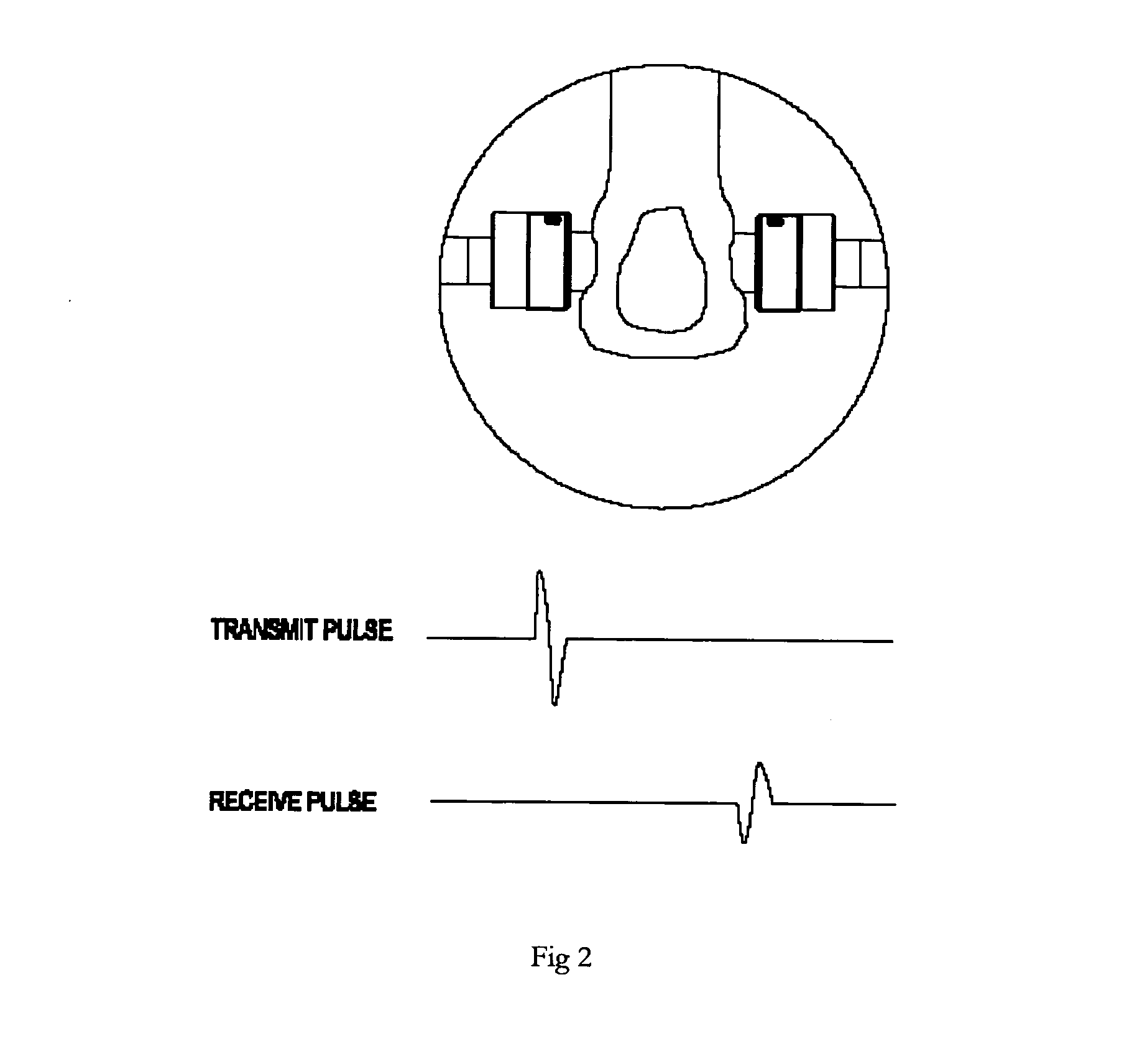 Bone densitometer and a method thereof