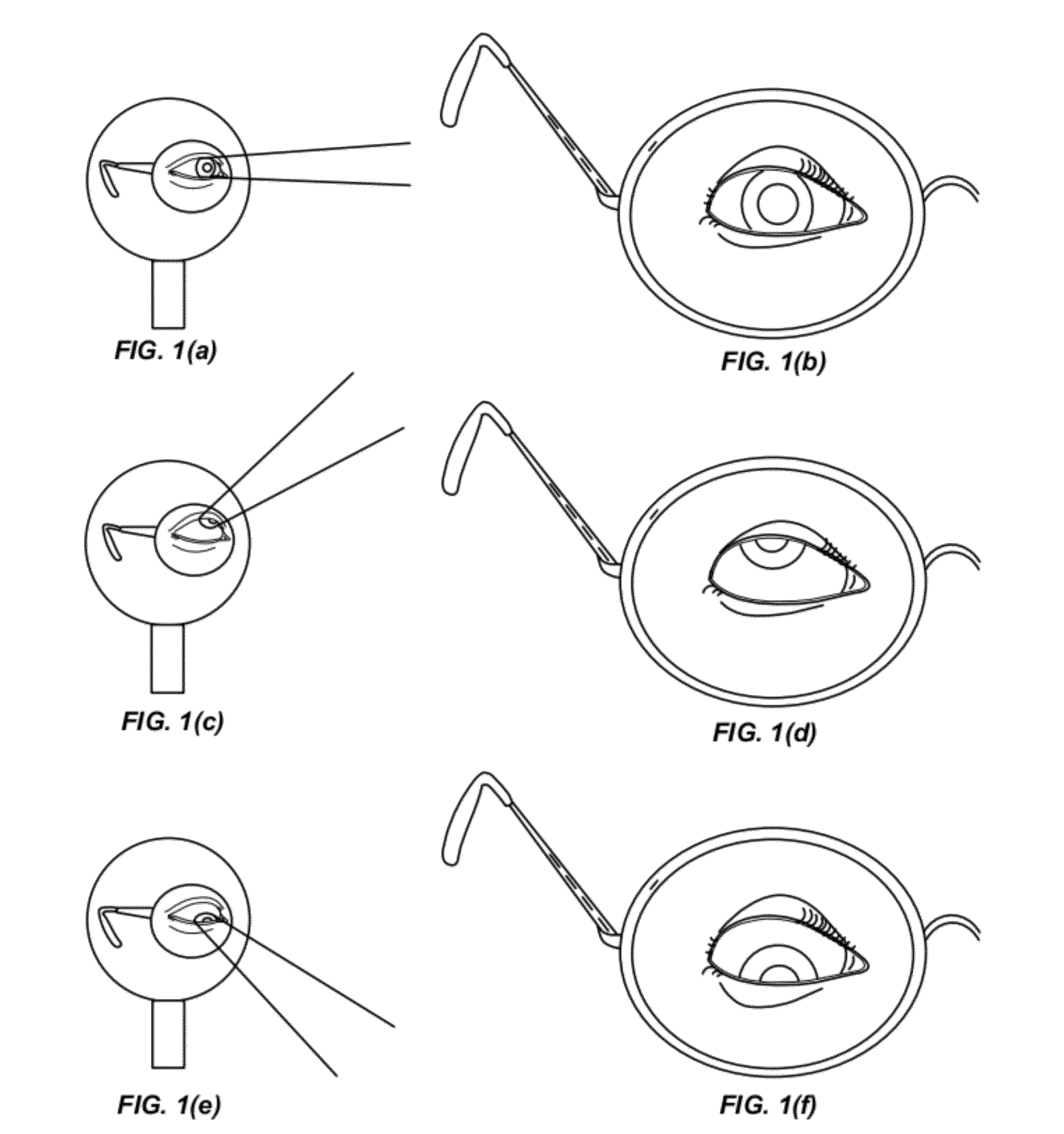 Translating multifocal eyeglass lenses