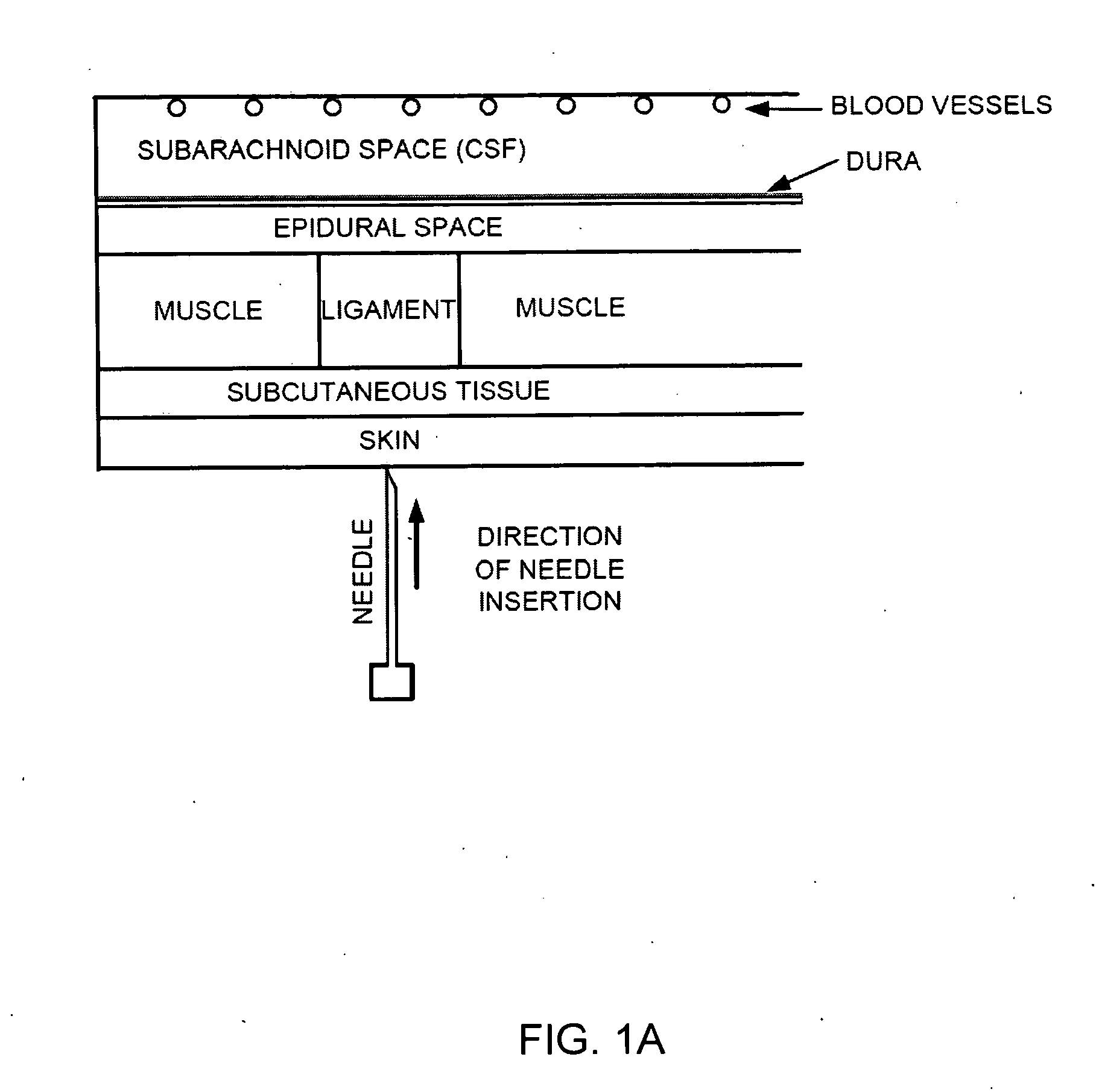 Spinal canal access and probe positioning, devices and methods