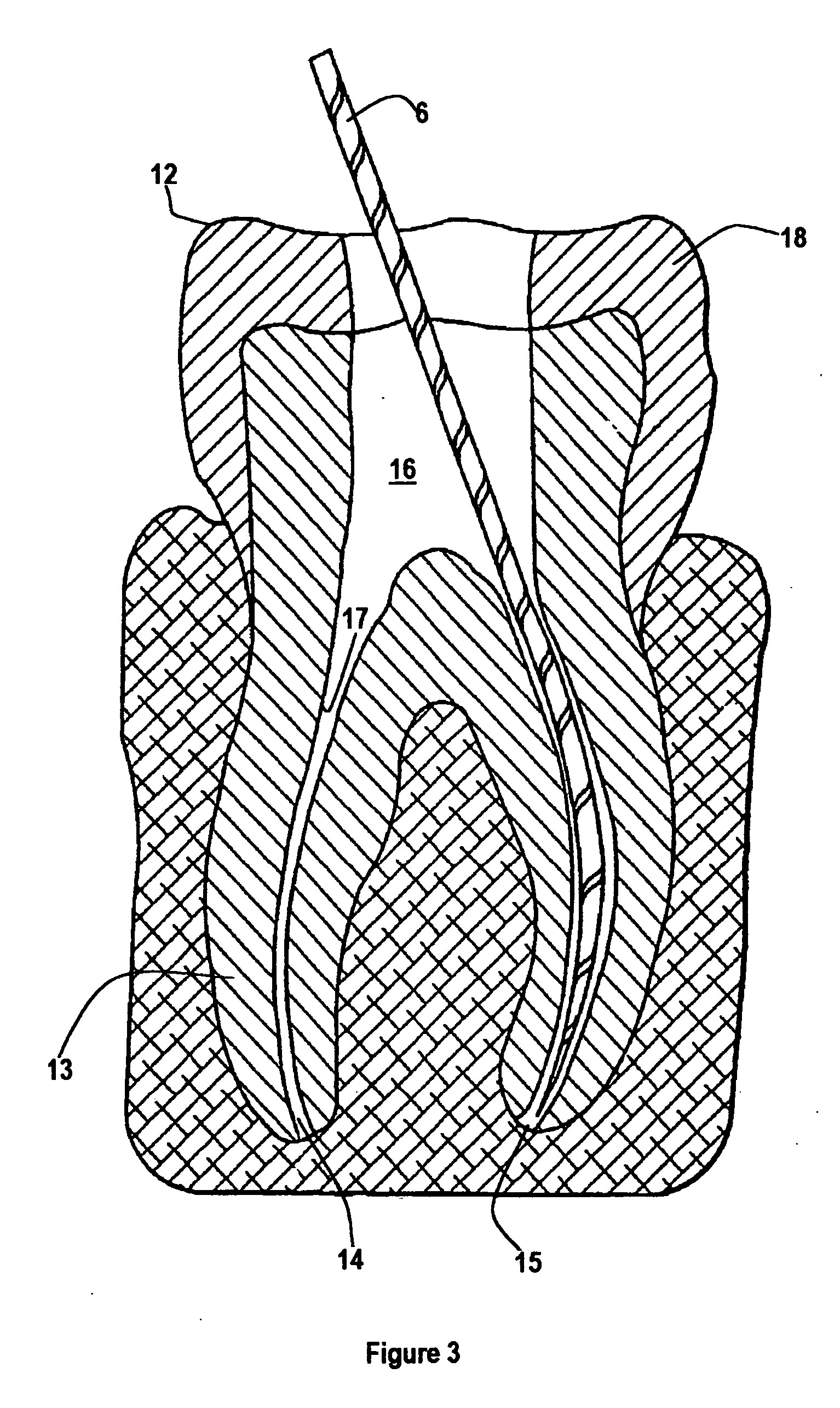 Rotary dental file having a safe breakage point