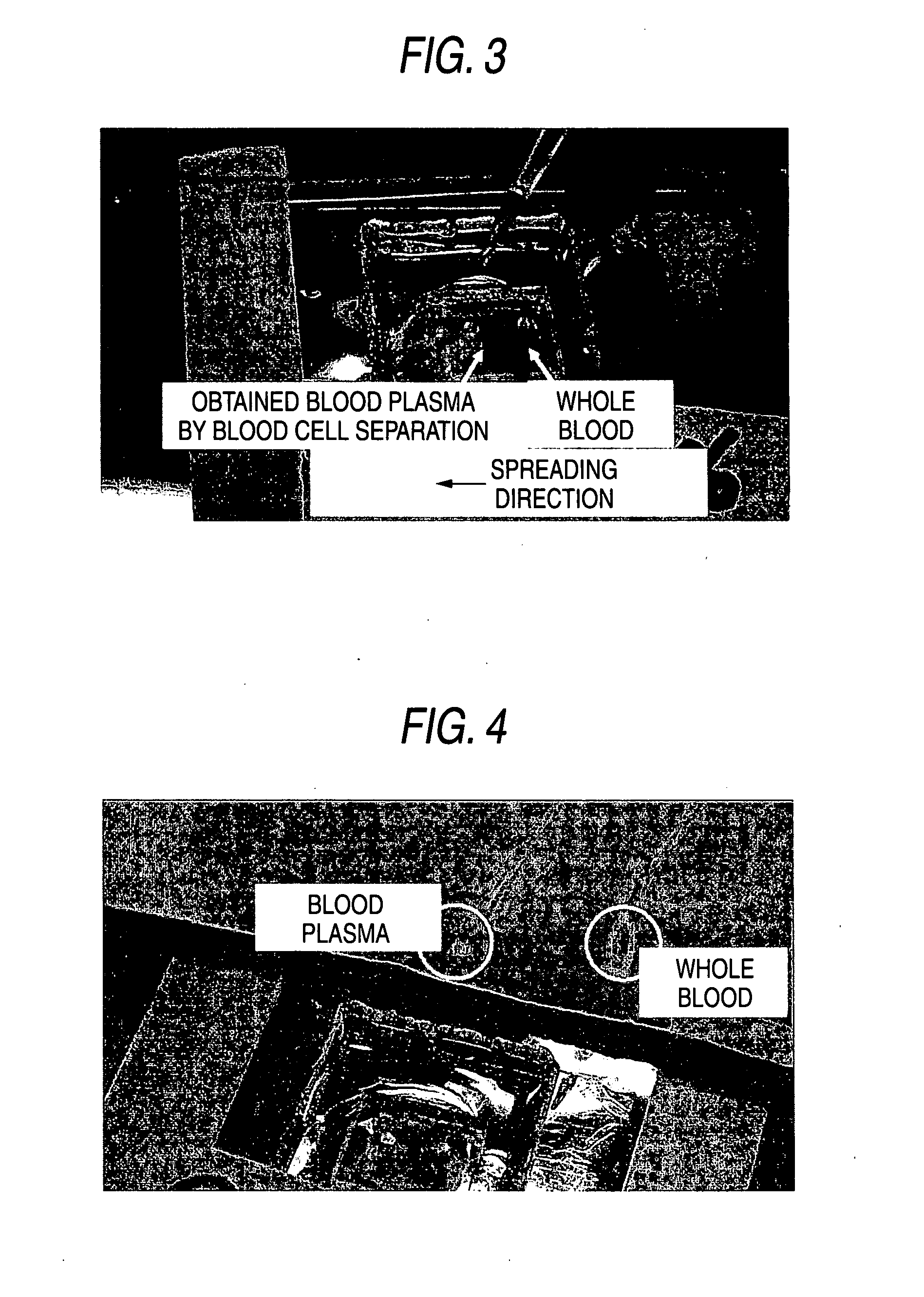 Filter for separating blood cells