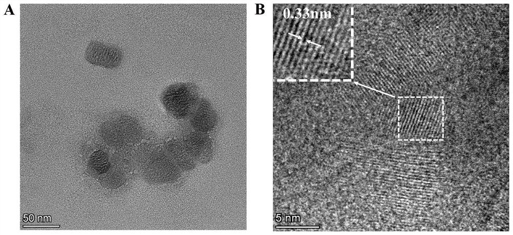 Preparation method and application of selenium-doped carbon quantum dots prepared based on selenium-enriched yeast