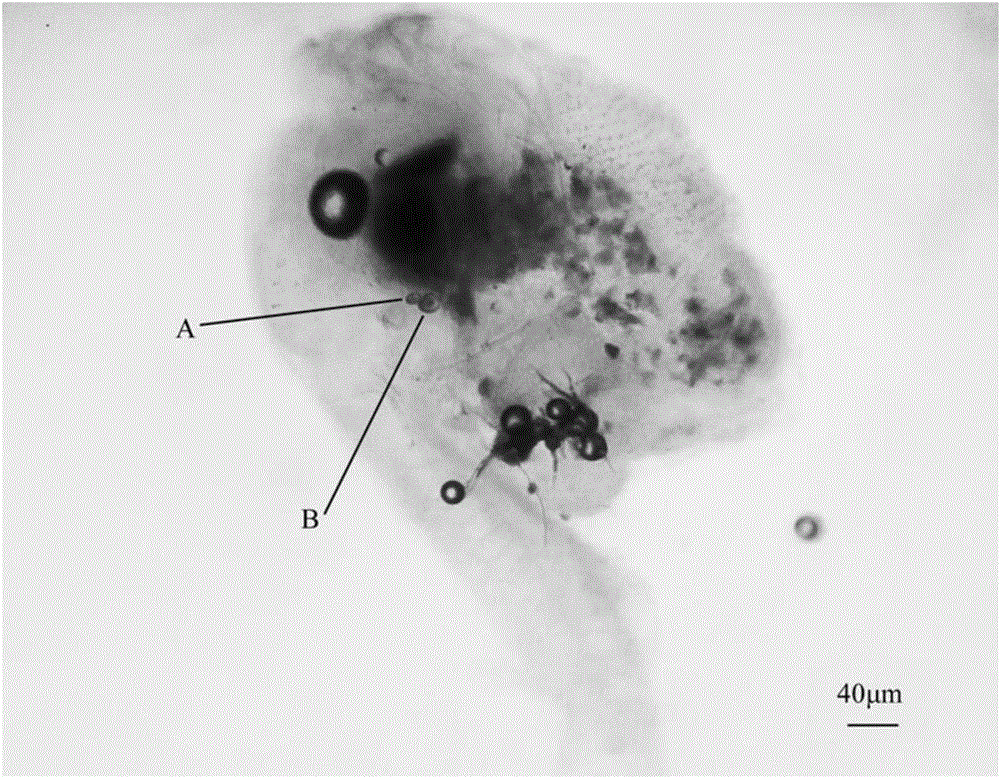 Method for preparing otolith sample for early life history of fish