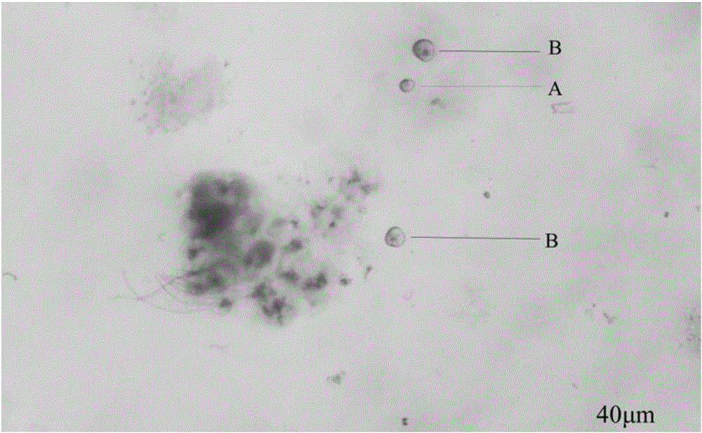 Method for preparing otolith sample for early life history of fish