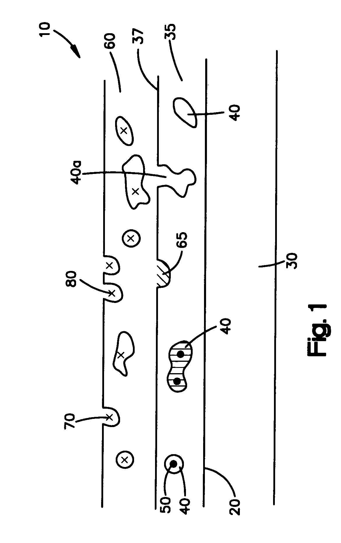 Medical devices comprising a porous metal oxide or metal material and a polymer coating for delivering therapeutic agents