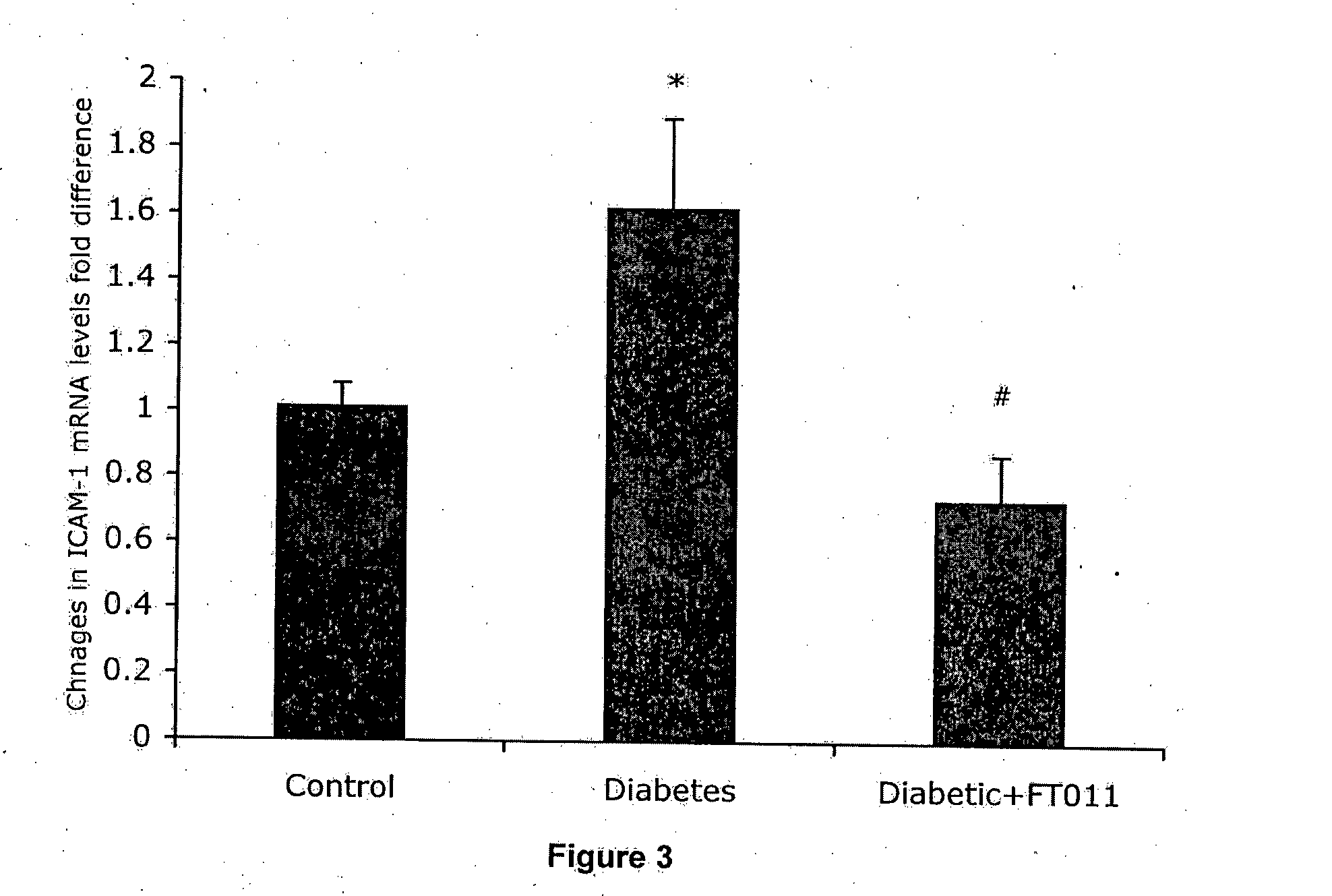 Methods of treating eye diseases associated with inflammation and vascular proliferation