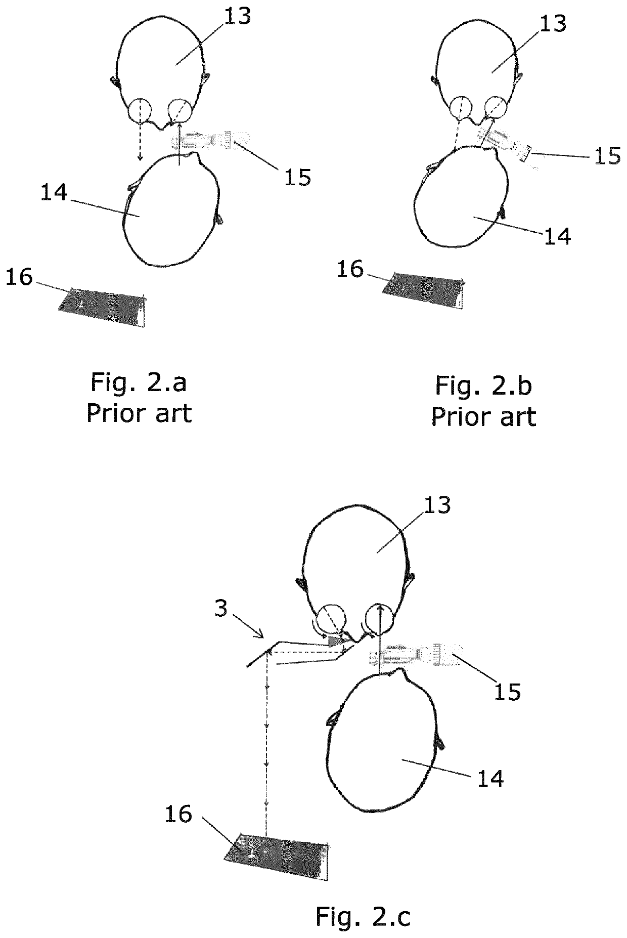 Method of examining an eye of a squinting person by use of a periscopic device and such a periscopic device