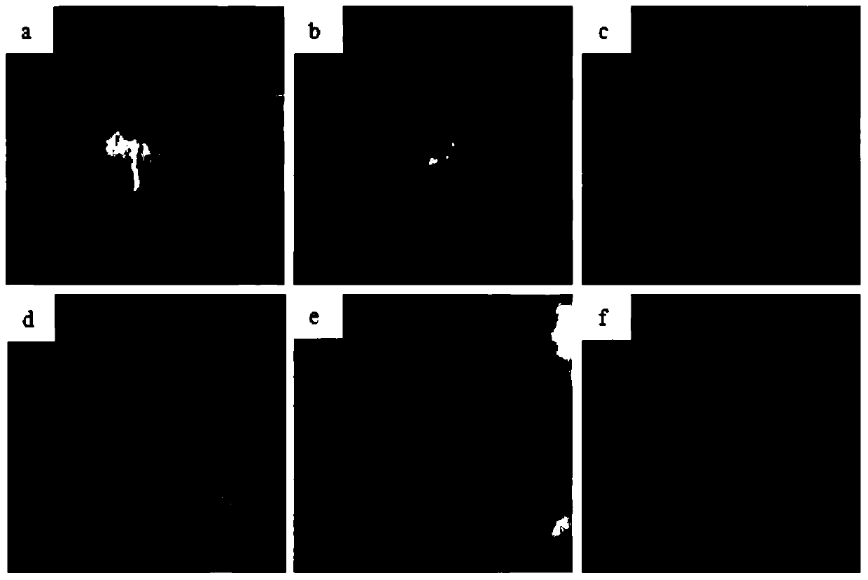 Nano-silver porous silicone rubber/polyurethane-containing double-layer artificial skin and preparation method thereof