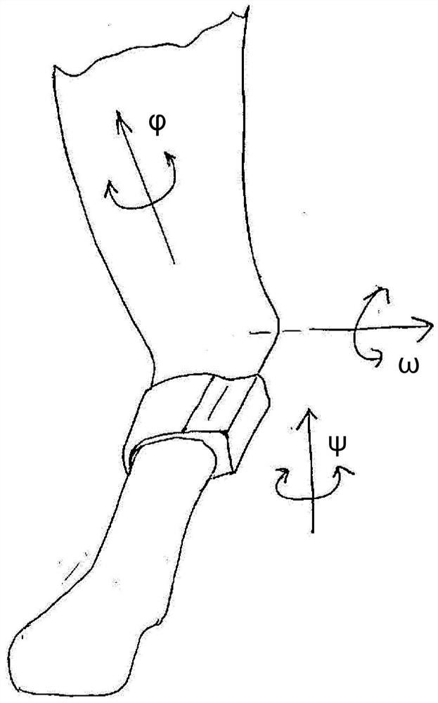 Gait-correcting systems to prevent degenerative diseases of joints and ligaments in dogs