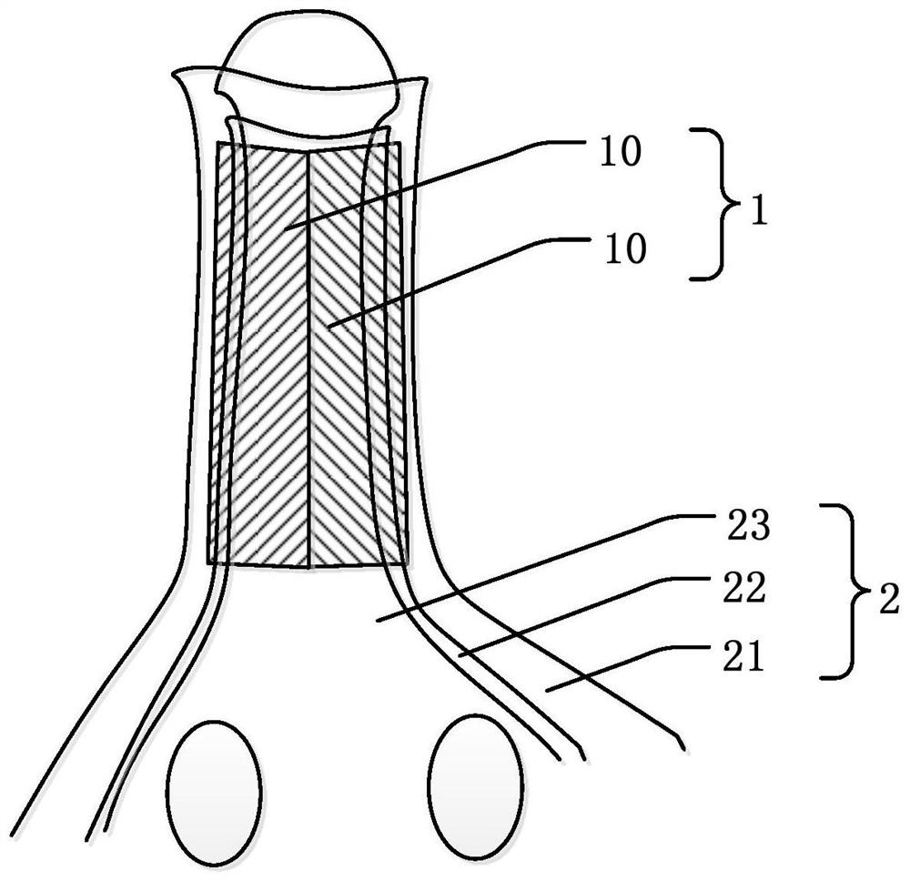 Temperature-sensitive stent