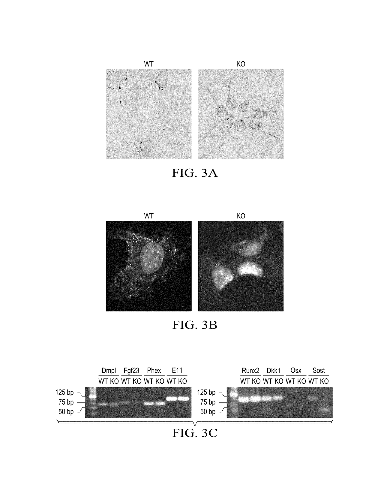 Prostacyclin compositions for regulation of fracture repair and bone formation