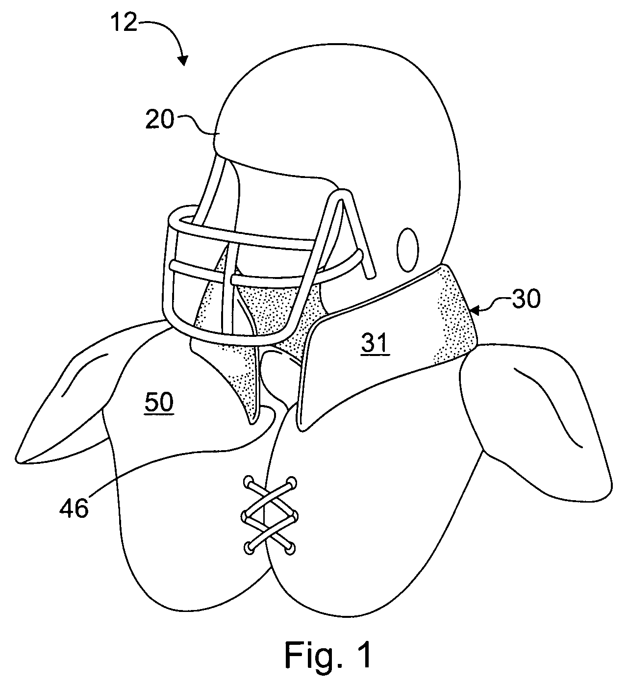 Head and neck protection system