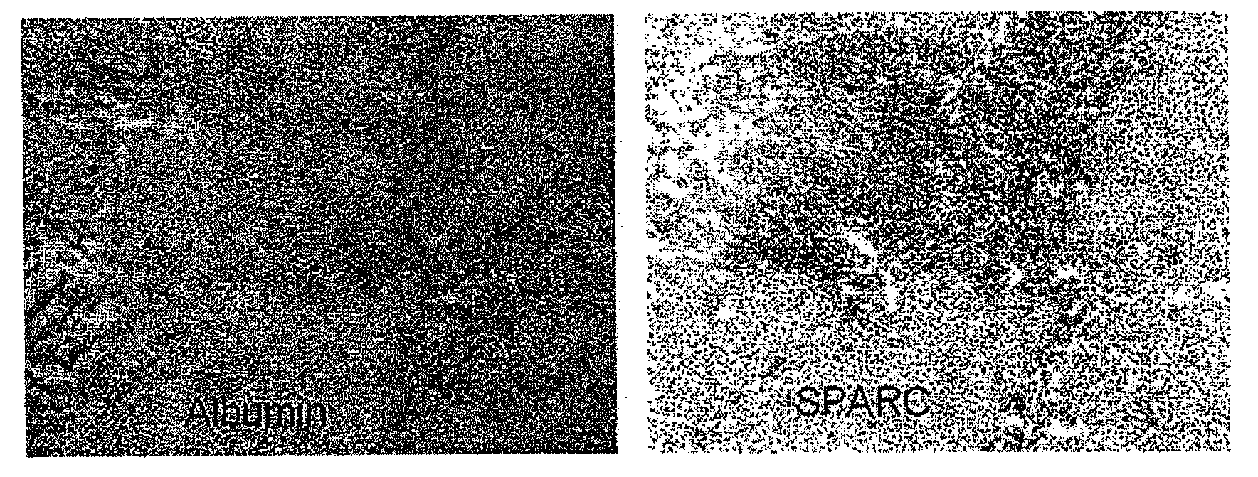 Sparc and methods of use thereof