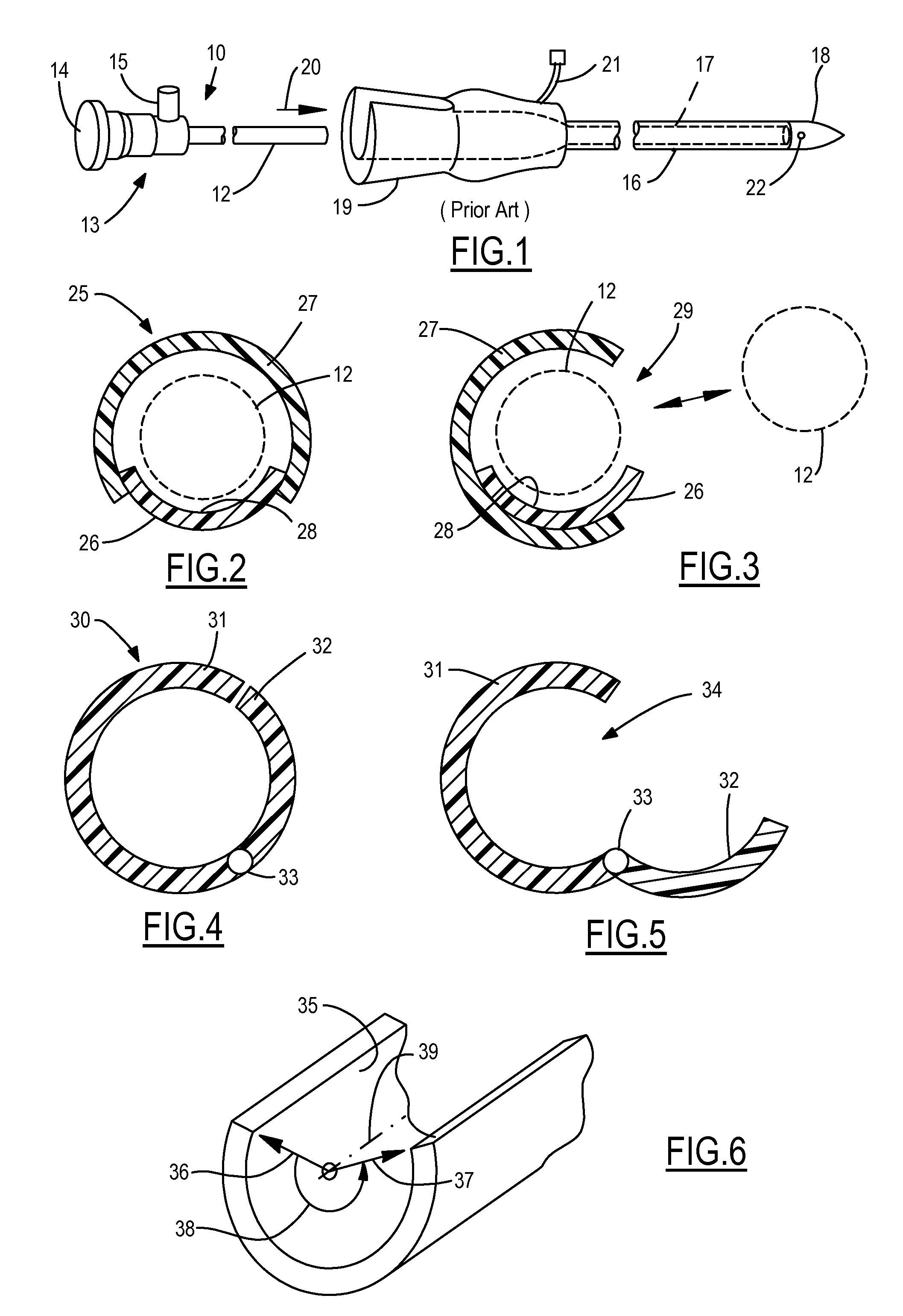 Endoscopic Vessel Dissector With Side Entry