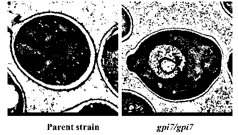 Candida albicans attenuated live vaccine as well as preparation method and application thereof