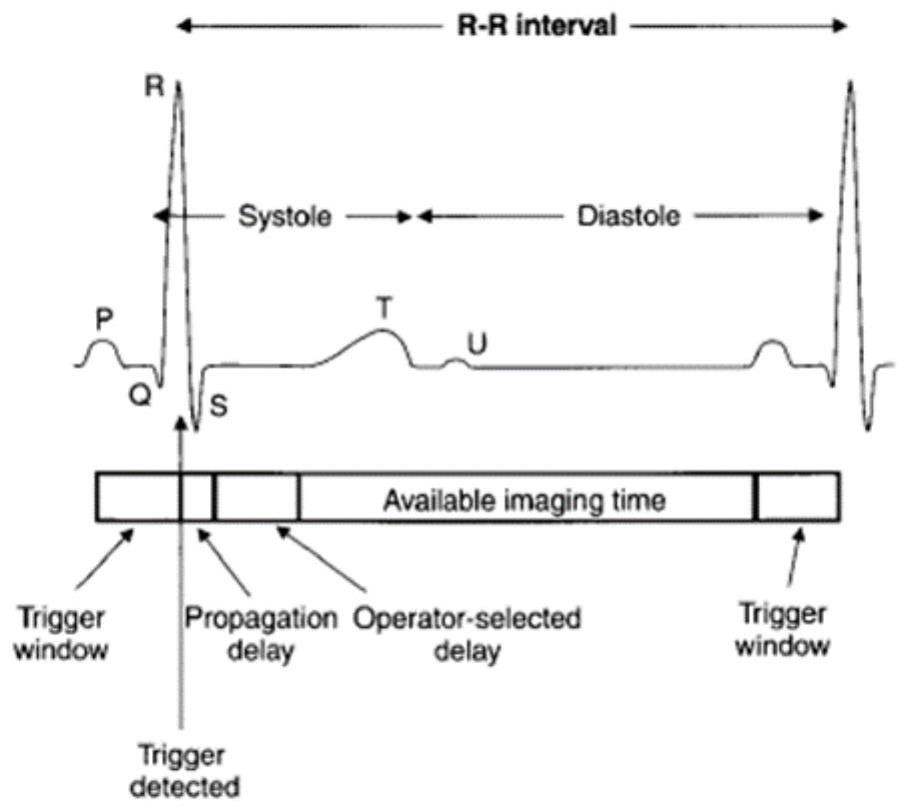 Heart image acquisition method and device, magnetic resonance equipment and storage medium