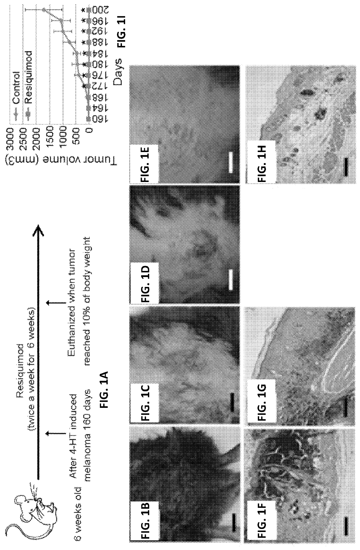 Resiquimod topical and injectable compositions for the treatment of neoplastic skin conditions