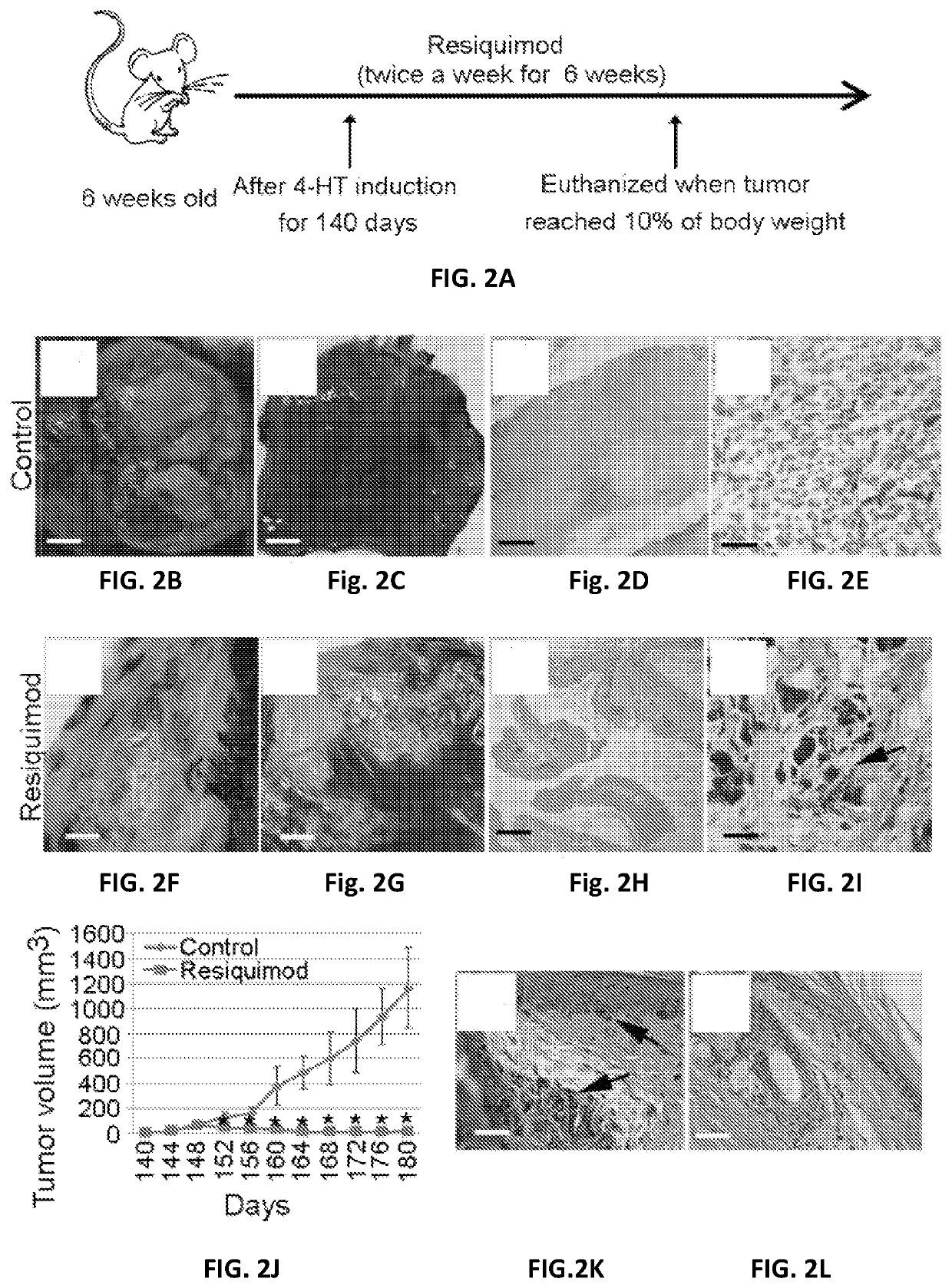 Resiquimod topical and injectable compositions for the treatment of neoplastic skin conditions