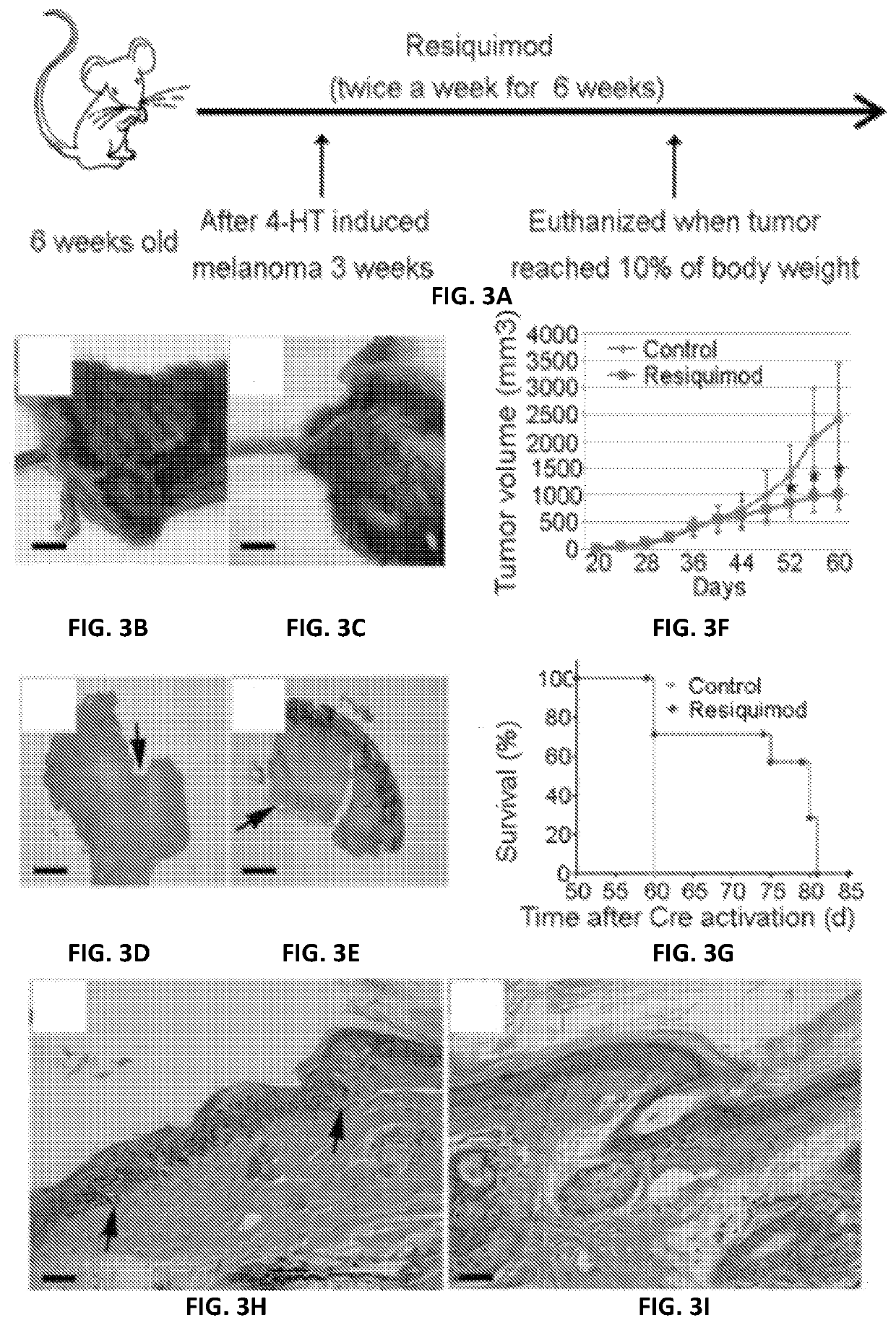 Resiquimod topical and injectable compositions for the treatment of neoplastic skin conditions