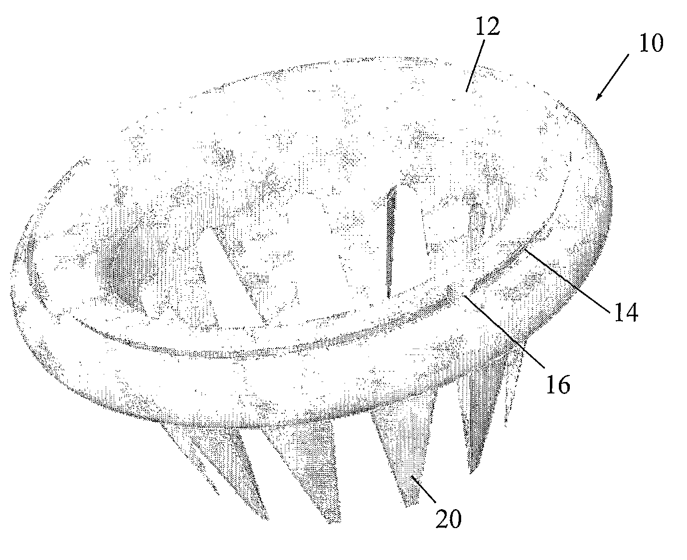 Hysterectomy ring