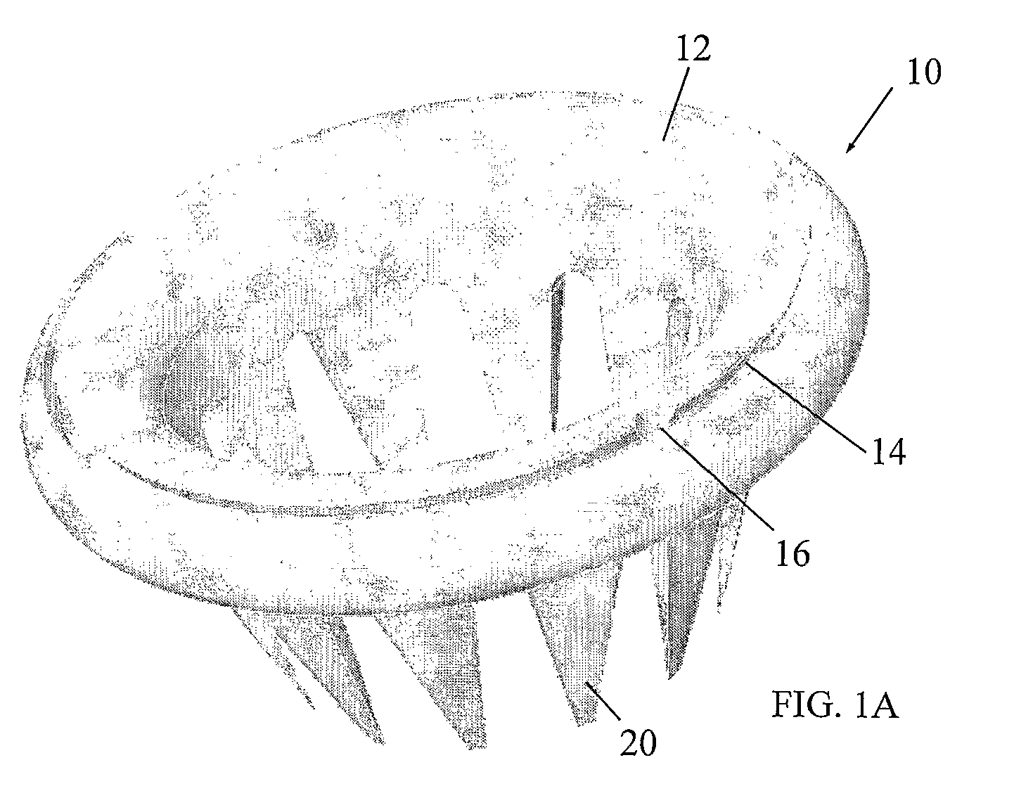 Hysterectomy ring