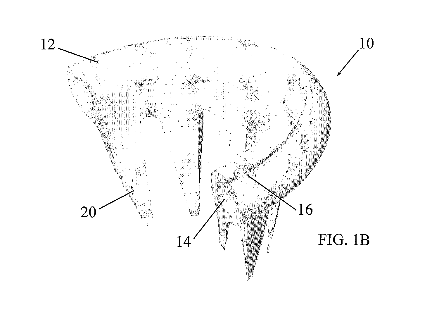 Hysterectomy ring