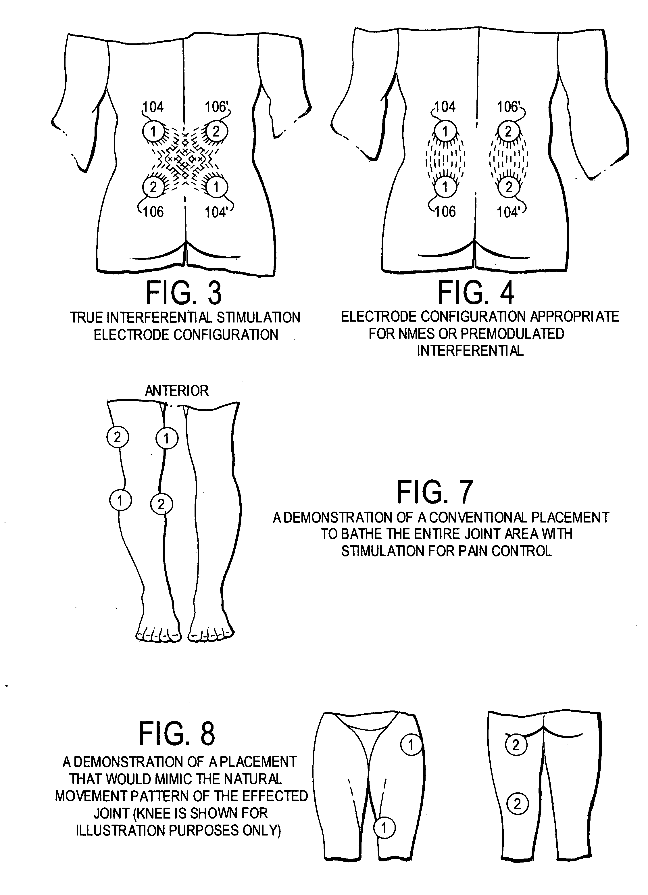 Switchable and programmable electrode configuration