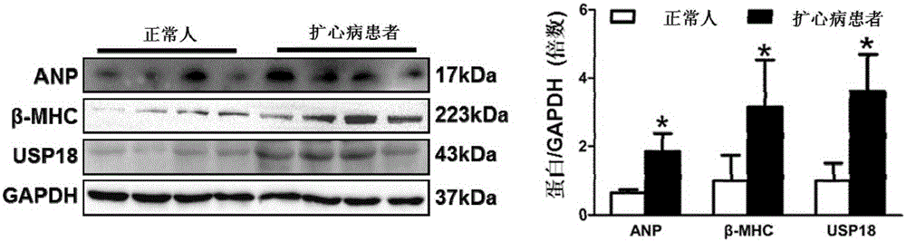 Function and application of ubiquitin-specific protease 18 (USP18) on treatment of cardiac hypertrophy