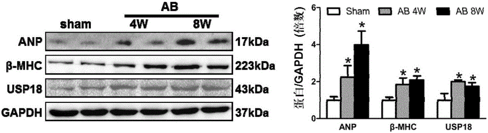 Function and application of ubiquitin-specific protease 18 (USP18) on treatment of cardiac hypertrophy