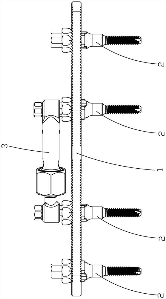 Clavicle fracture percutaneous reduction distraction pressurization fixing device