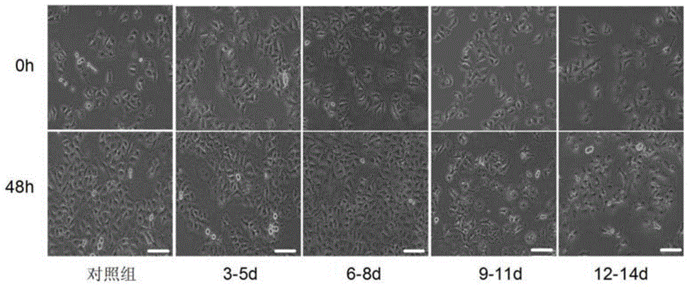 New application of cells matched with tumor cell developmental stage and extract of cells