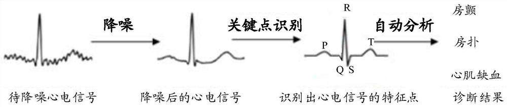 Training method for noise reduction autoencoder, noise reduction method for ECG signal, and related devices and equipment