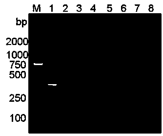 Bacillus erysipelatos-suis PCR (Polymerase Chain Reaction) primer and application thereof