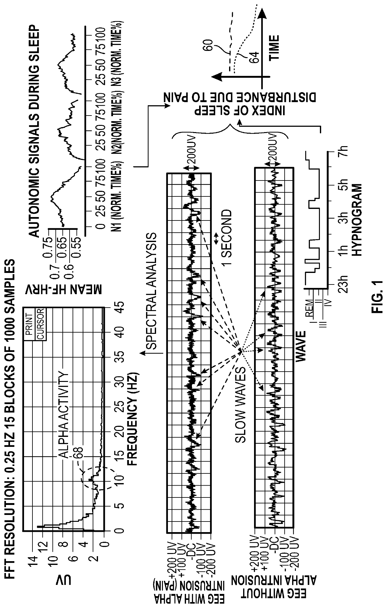 Macro/micro-structure of sleep and similar states of consciousness to optimize pain treatment