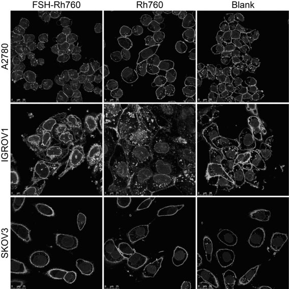 Tumor imaging and treatment probe of targeted follicle-stimulating hormone receptor as well as preparation method and application of tumor imaging and treatment probe