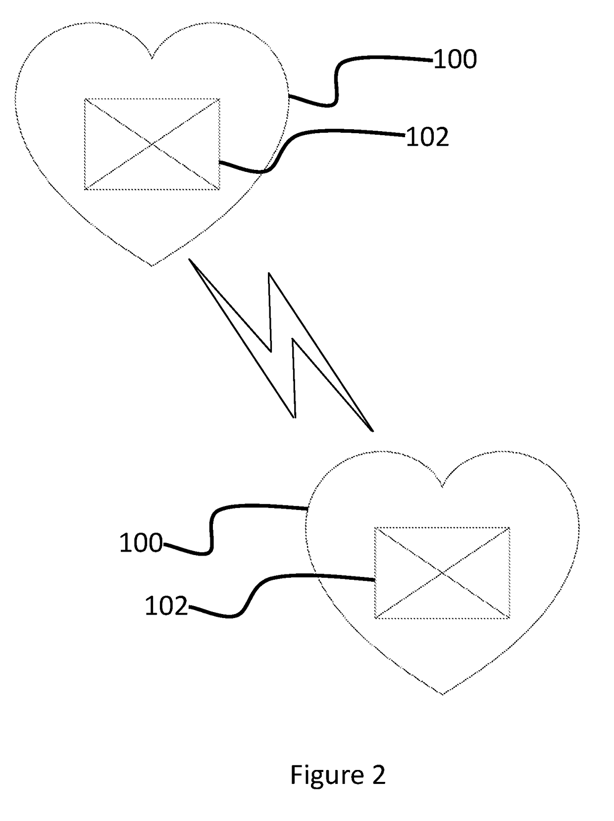 Wearable sensor