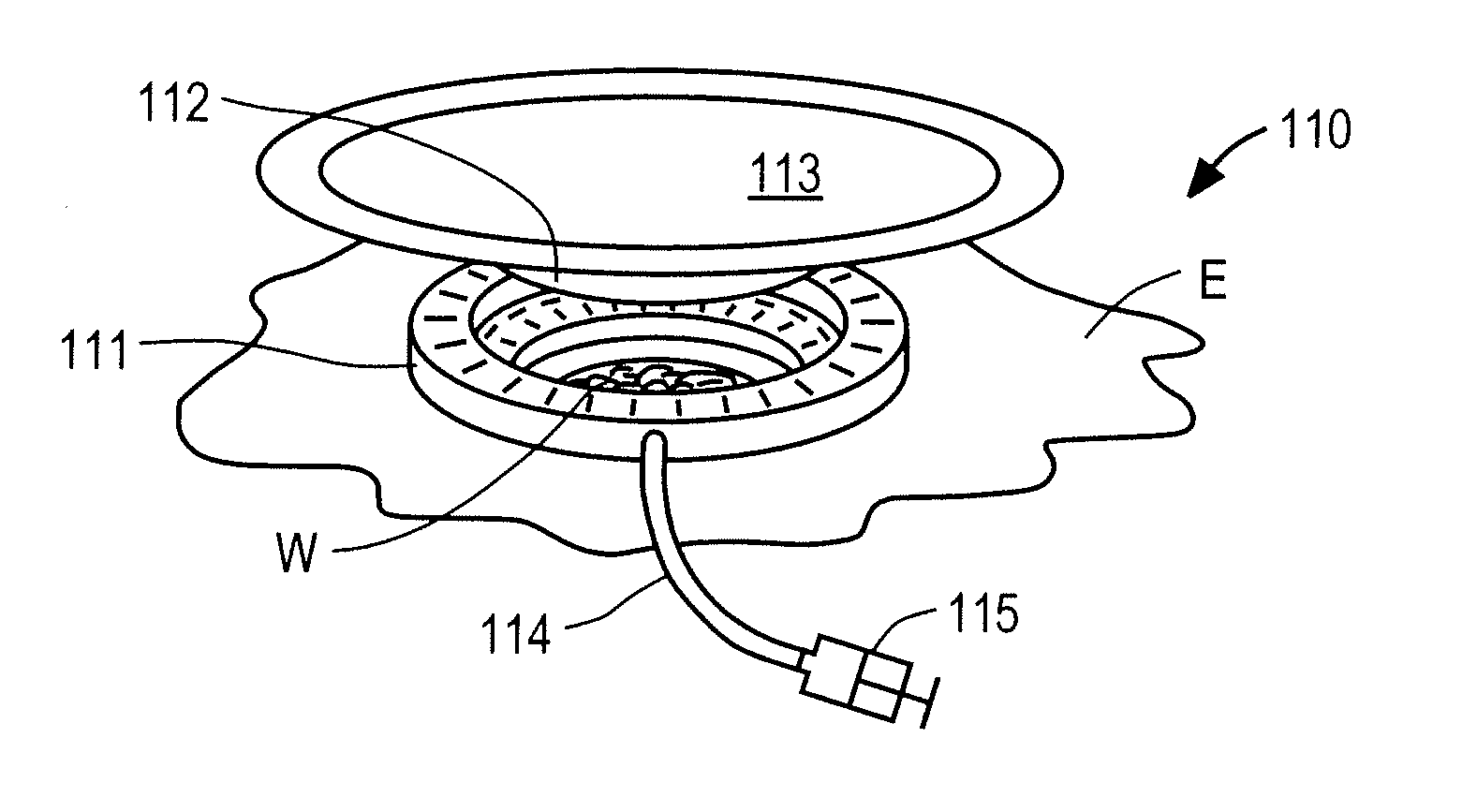 Systems And Methods For Wound Protection And Exudate Management