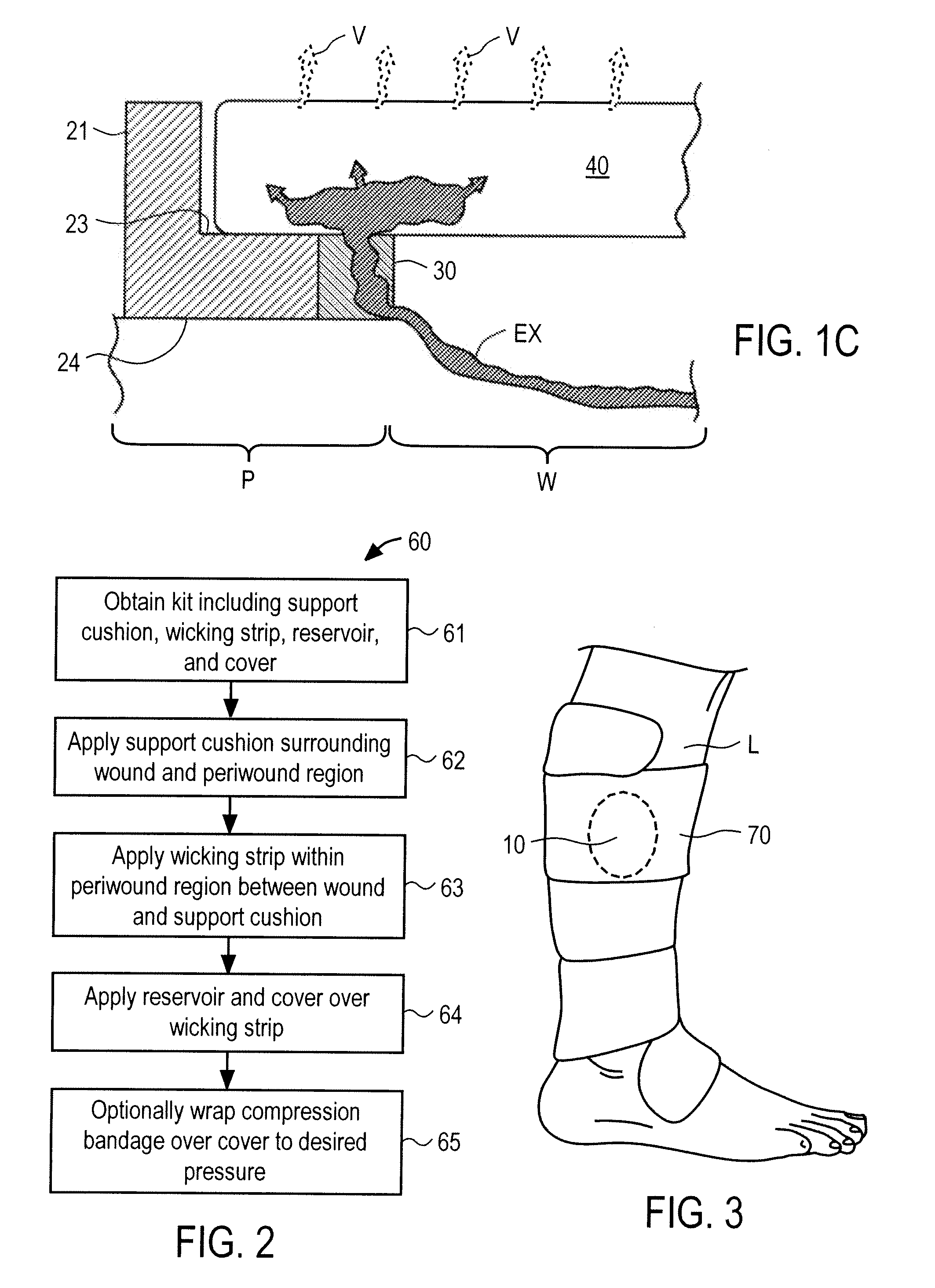 Systems And Methods For Wound Protection And Exudate Management