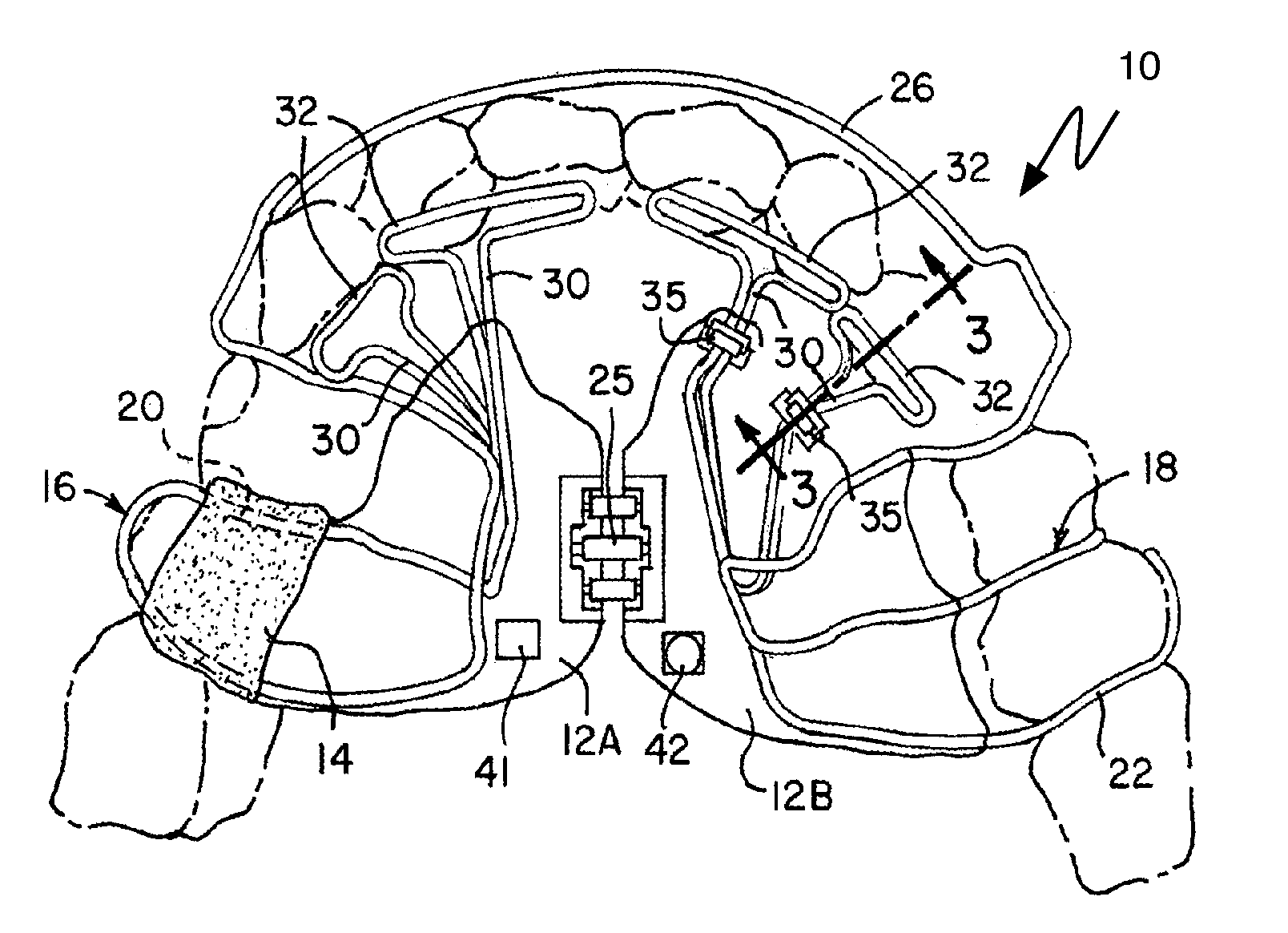 System and method to bioengineer facial form in adults