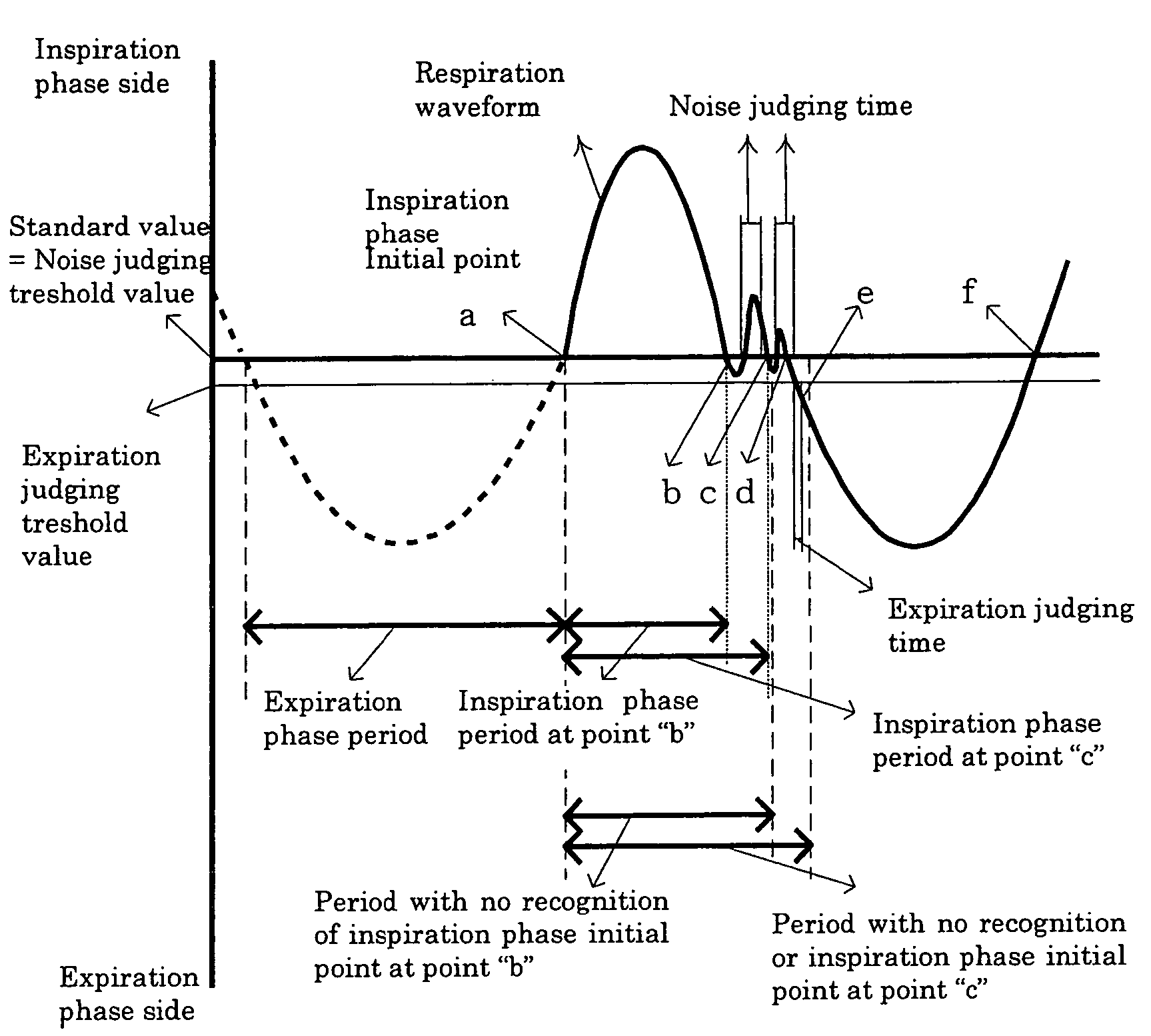 Respiration-synchronous gas supplying device