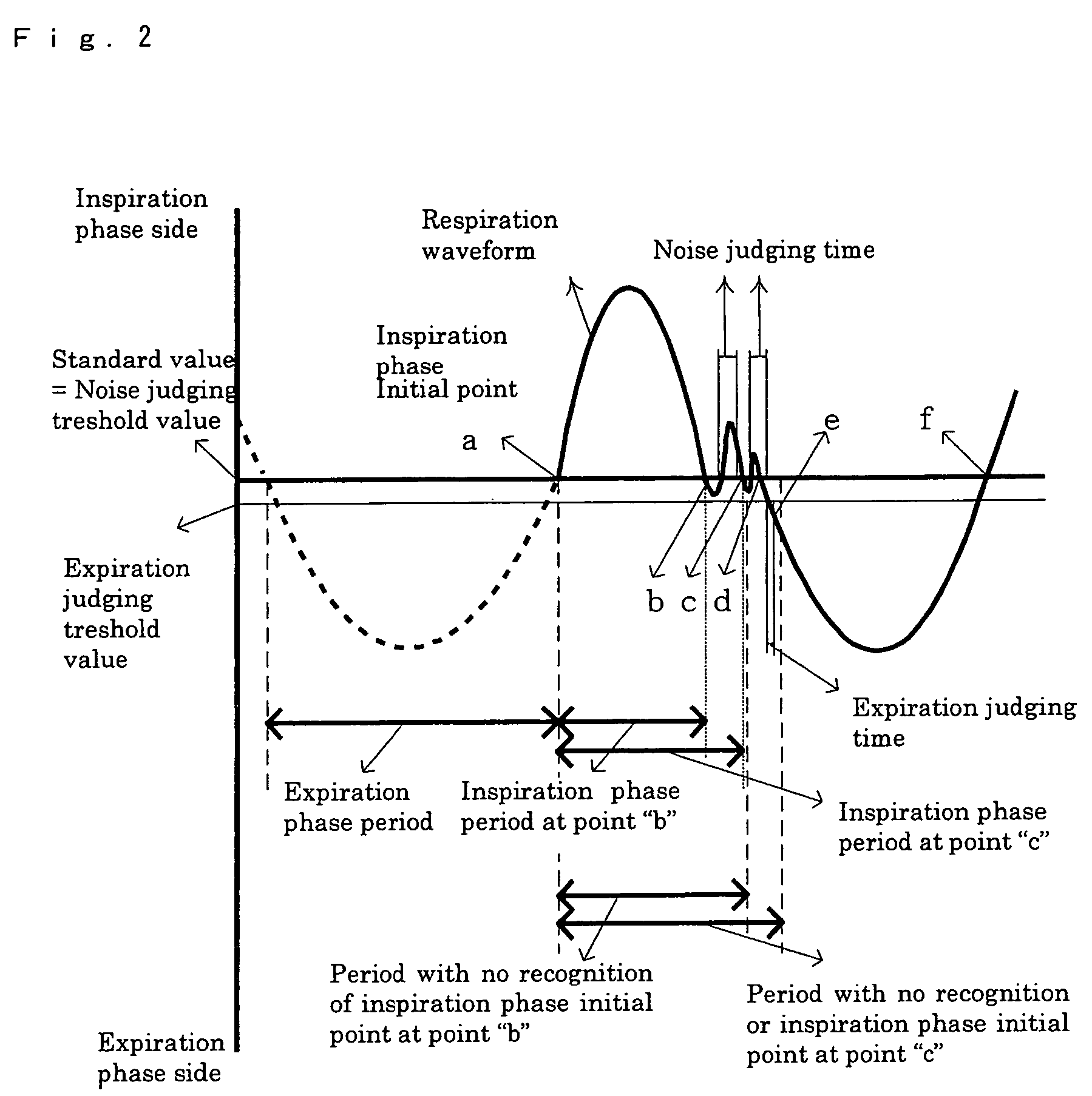 Respiration-synchronous gas supplying device