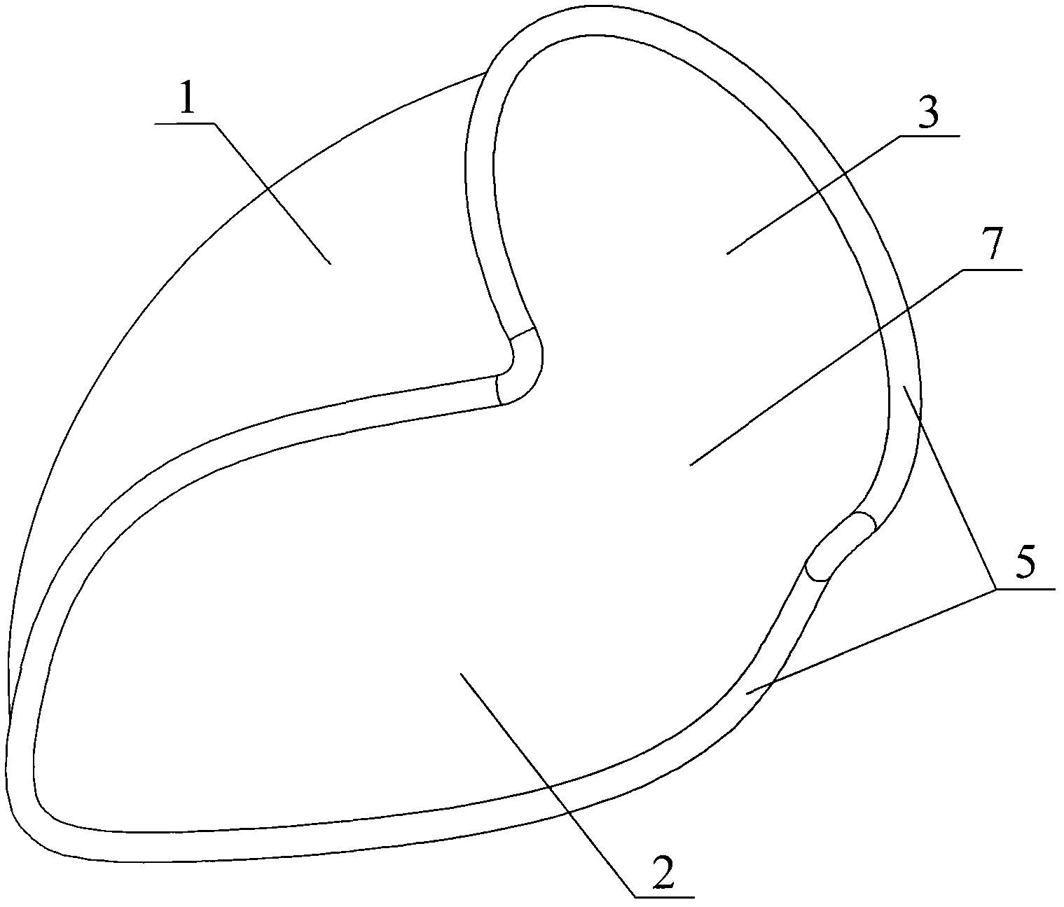 Bridge vessels-proximal anastomosis supporting device for coronary artery bypass grafting and manufacturing method of bridge vessels-proximal anastomosis supporting device