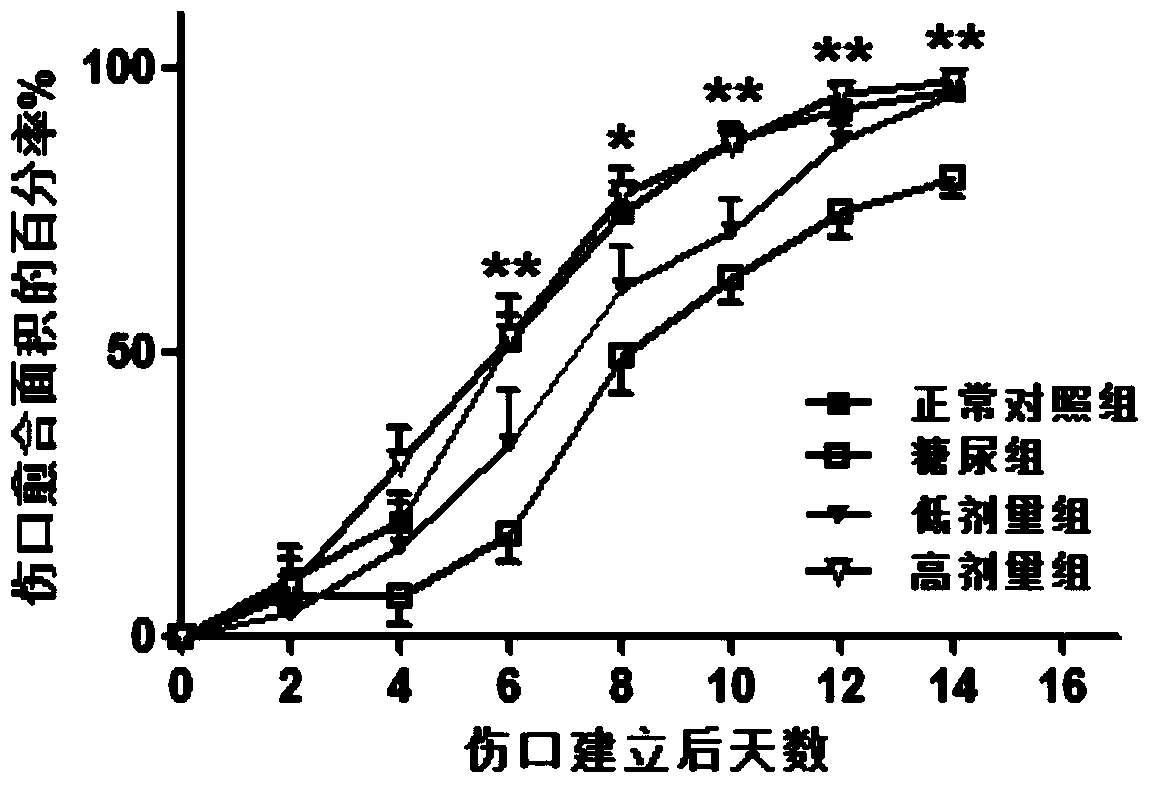 Novel use of the FoxO1 selective inhibitor AS1842856