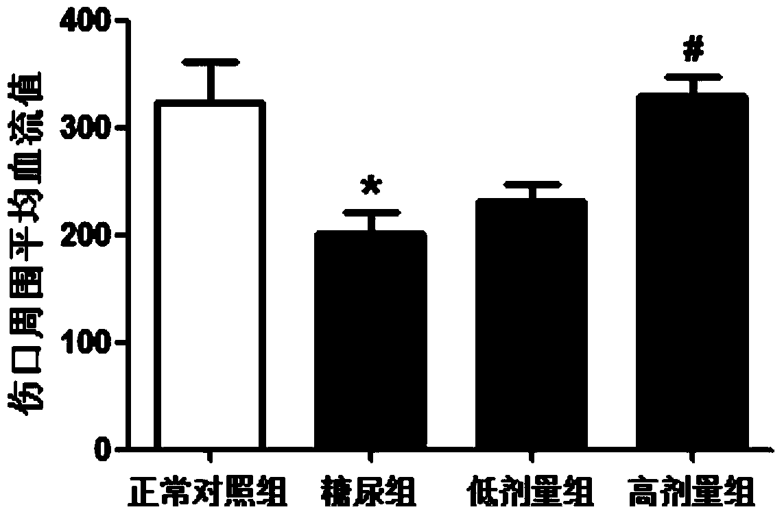 Novel use of the FoxO1 selective inhibitor AS1842856