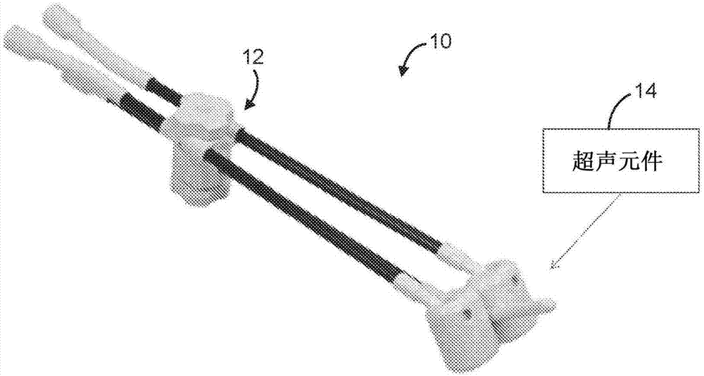 Brachytherapy applicators having ultrasound elements